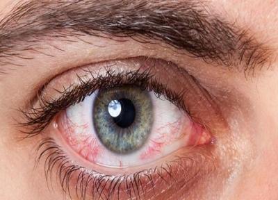 به تعویق انداختن درمان کدام یک از بیماری های چشمی خطرناک است؟